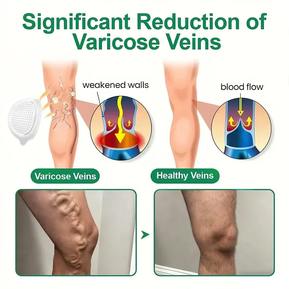 ๐๐ฎ๐ซ๐๐ฅ๐จ๐ซ๐ยฎ ๐๐๐ญ๐๐๐จ๐ฅ๐ข๐ ๐๐๐ญ๐ซ๐ข๐ฑโข โ ๐๐๐ + ๐๐ฆ๐๐ซ๐๐ฌ๐๐ญ๐ ๐๐-๐ข๐ง-๐ ๐๐๐ง๐จ ๐๐ข๐๐ซ๐จ๐ง๐๐๐๐ฅ๐ ๐๐๐ญ๐๐ก (๐ง๐๐ฎ๐ฌ๐ญ ๐๐ง๐๐ ๐ ๐๐๐ฒ โ ๐๐ข๐ฌ๐ข๐๐ฅ๐ ๐๐๐ฌ๐ฎ๐ฅ๐ญ๐ฌ ๐ข๐ง ๐ ๐๐๐ฒ๐ฌ!) โ
๐๐๐๐ค๐ฅ๐๐ฌ ๐จ๐๐๐ฌ๐ข๐ญ๐ฒ, ๐ฅ๐จ๐จ๐ฌ๐ ๐ฌ๐ค๐ข๐ง, ๐๐ข๐๐๐๐ญ๐๐ฌ, ๐ฌ๐ฅ๐๐๐ฉ ๐ข๐ฌ๐ฌ๐ฎ๐๐ฌ, ๐ฃ๐จ๐ข๐ง๐ญ ๐ฉ๐๐ข๐ง, ๐๐ง๐ ๐ฌ๐ฎ๐ฉ๐ฉ๐จ๐ซ๐ญ๐ฌ ๐ฏ๐๐ข๐ง & ๐ฅ๐ฒ๐ฆ๐ฉ๐ก๐๐ญ๐ข๐ ๐๐ข๐ซ๐๐ฎ๐ฅ๐๐ญ๐ข๐จ๐ง - Image 16