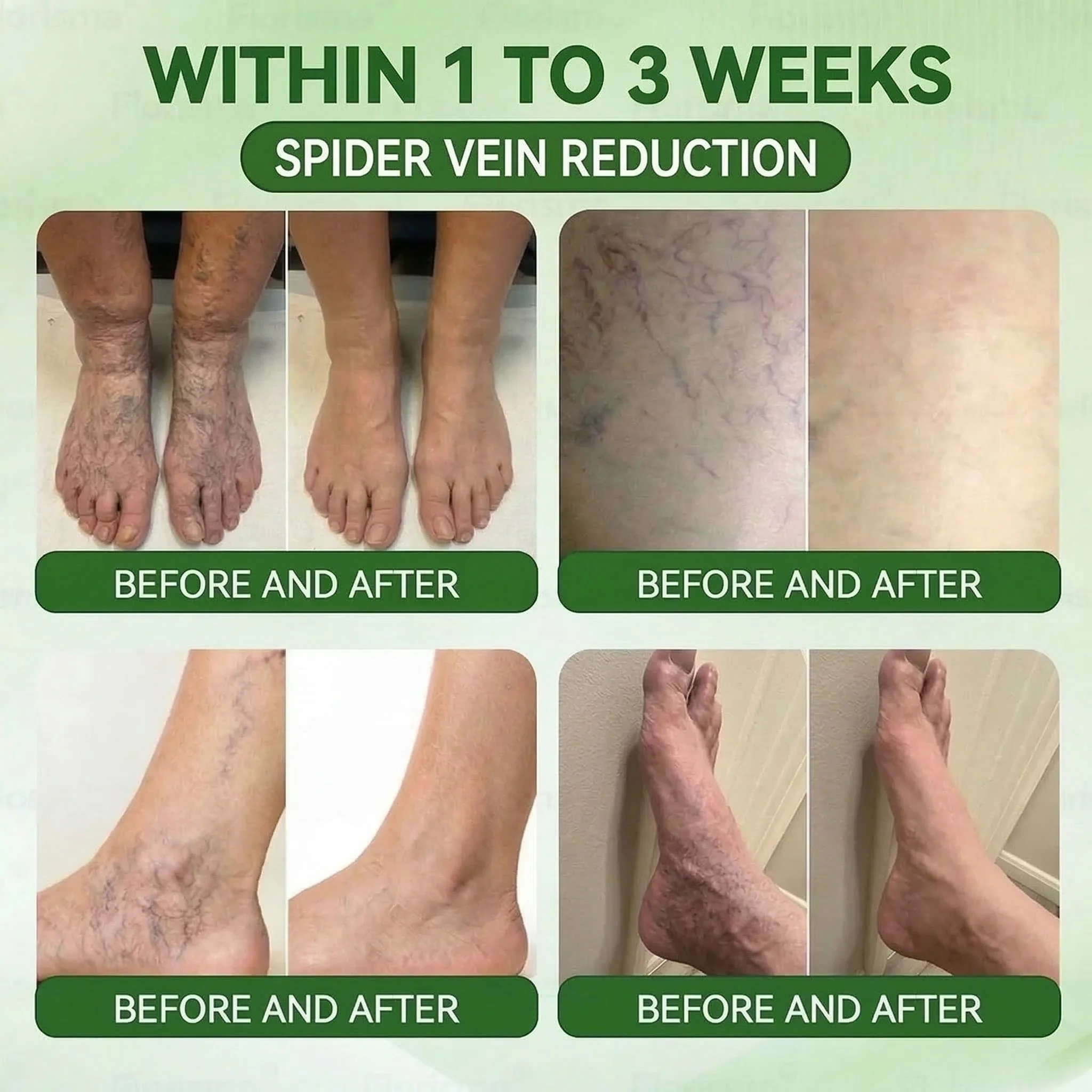 ๐๐ฎ๐ซ๐๐ฅ๐จ๐ซ๐ยฎ ๐๐๐ญ๐๐๐จ๐ฅ๐ข๐ ๐๐๐ญ๐ซ๐ข๐ฑโข โ ๐๐๐ + ๐๐ฆ๐๐ซ๐๐ฌ๐๐ญ๐ ๐๐-๐ข๐ง-๐ ๐๐๐ง๐จ ๐๐ข๐๐ซ๐จ๐ง๐๐๐๐ฅ๐ ๐๐๐ญ๐๐ก (๐ง๐๐ฎ๐ฌ๐ญ ๐๐ง๐๐ ๐ ๐๐๐ฒ โ ๐๐ข๐ฌ๐ข๐๐ฅ๐ ๐๐๐ฌ๐ฎ๐ฅ๐ญ๐ฌ ๐ข๐ง ๐ ๐๐๐ฒ๐ฌ!) โ
๐๐๐๐ค๐ฅ๐๐ฌ ๐จ๐๐๐ฌ๐ข๐ญ๐ฒ, ๐ฅ๐จ๐จ๐ฌ๐ ๐ฌ๐ค๐ข๐ง, ๐๐ข๐๐๐๐ญ๐๐ฌ, ๐ฌ๐ฅ๐๐๐ฉ ๐ข๐ฌ๐ฌ๐ฎ๐๐ฌ, ๐ฃ๐จ๐ข๐ง๐ญ ๐ฉ๐๐ข๐ง, ๐๐ง๐ ๐ฌ๐ฎ๐ฉ๐ฉ๐จ๐ซ๐ญ๐ฌ ๐ฏ๐๐ข๐ง & ๐ฅ๐ฒ๐ฆ๐ฉ๐ก๐๐ญ๐ข๐ ๐๐ข๐ซ๐๐ฎ๐ฅ๐๐ญ๐ข๐จ๐ง - Image 6